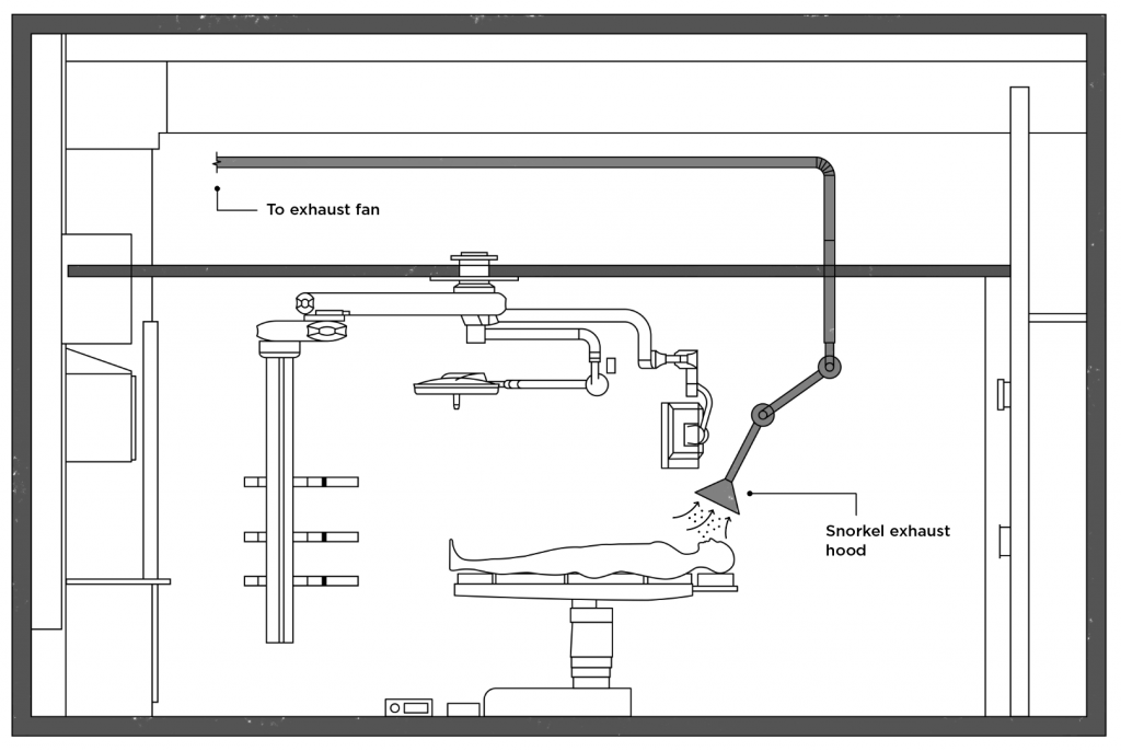 operating room (OR) snorkel sketch
